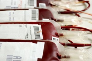 trasfusione sangue