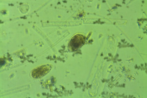 alga-ostreopsis-ovata