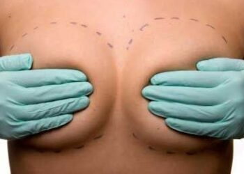 Protesi mammarie, arriva il divieto per le minorenni