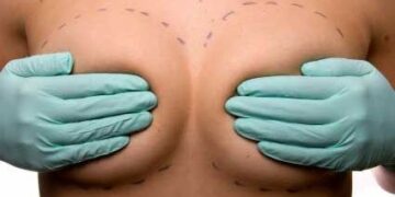 Protesi mammarie, arriva il divieto per le minorenni