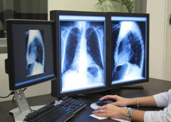 Sanita’, Asp Crotone all’avanguardia nella radiologia