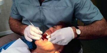 Cosenza: falso dentista evade 700 mila euro