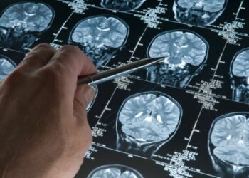 Ictus, screening gratutiti per la prevenzione a Ciro’ Marina