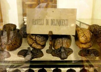 Ciro’ contro il Museo Lombroso, in mostra crani e volti di meridionali