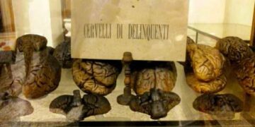 Ciro’ contro il Museo Lombroso, in mostra crani e volti di meridionali