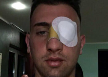 Pallanuoto, Cosenza nuoto – R.N. Auditore Crotone 4 – 5. Aggredito il portiere