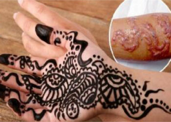 Tatuaggio sulla spiaggia, rischio cicatrici permanenti