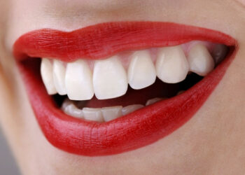 Acqua ossigenata per sbiancare i denti, è allarme per la salute