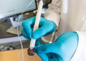 Una penna diagnostica i tumori in 10 secondi