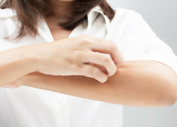 Il 28 ottobre l’Ospedale Tiberio Evoli di Melito Porto Salvo è aperto per visite gratuite a persone affette da psoriasi