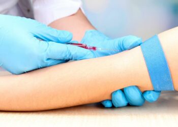 Nuova analisi del sangue rileverebbe la patologia fino a 20 anni in anticipo