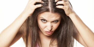 Alopecia femminile, chiamata anche Calvizie femminile