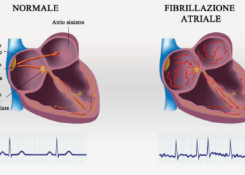 “La Musica del Cuore”, in Calabria la Giornata di Screening gratuiti della Fibrillazione Atriale