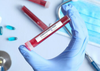 Coronavirus, Bollettino Asp Crotone: 67 casi positivi (+4 rispetto a ieri), 18 ricoverati all’Ospedale San Giovanni di Dio