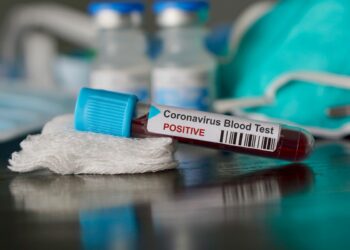 Coronavirus: l’Asp di Crotone è pronta a fare i tamponi, ma mancano ancora i kit per effettuare i test