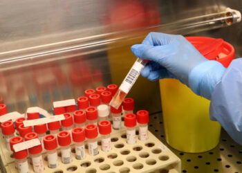 Coronavirus: 28 nuovi contagi in Calabria, Bollettino del 12 luglio