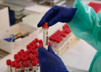 Coronavirus, salgono ancora contagi in Calabria: 32 nuovi positivi, Bollettino di oggi 2 settembre