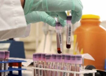 Covid, Regione aderisce a progetto europeo per raccolta plasma