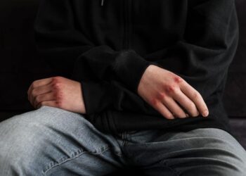 Cirò Marina, violenza tra giovani e giovanissimi: interviene il consigliere comunale Antonio Pace